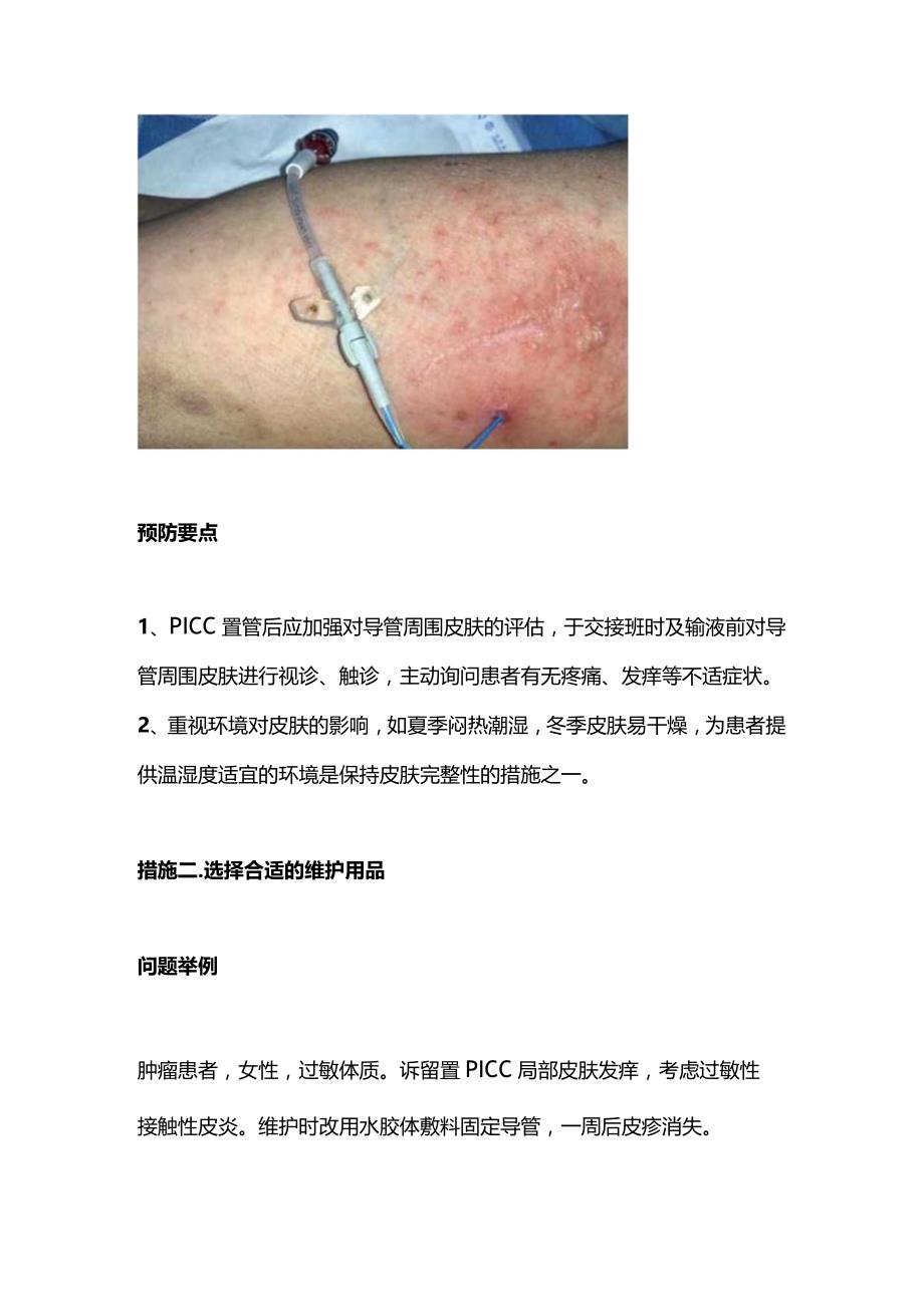 PICC置管相关皮肤损伤的预防2024.docx_第2页