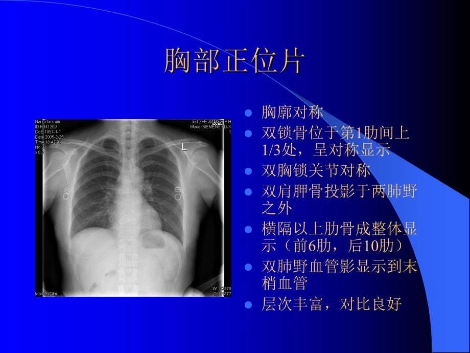 医院放射科常规投照位置检查规程和质量控制标准.ppt_第2页