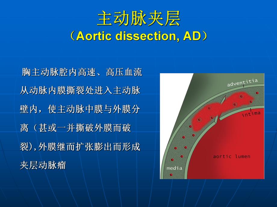 主动脉综合征.ppt_第3页