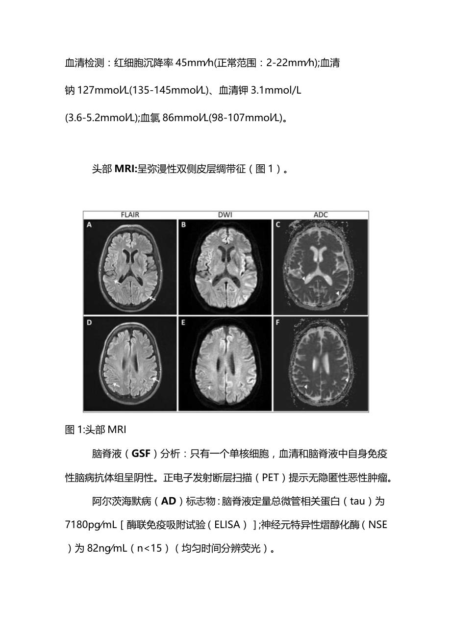 2024致命的神经退行性疾病（附表）.docx_第2页