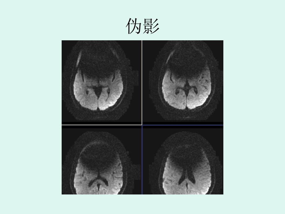 医院影像报告的描述技巧.ppt_第2页