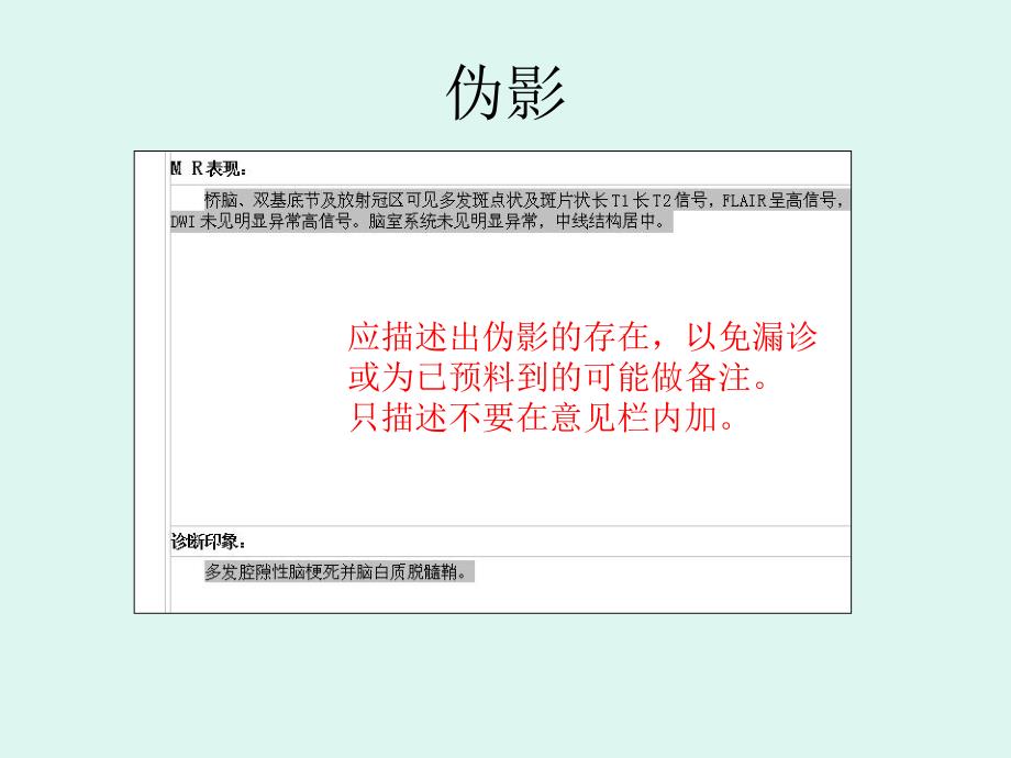 医院影像报告的描述技巧.ppt_第3页