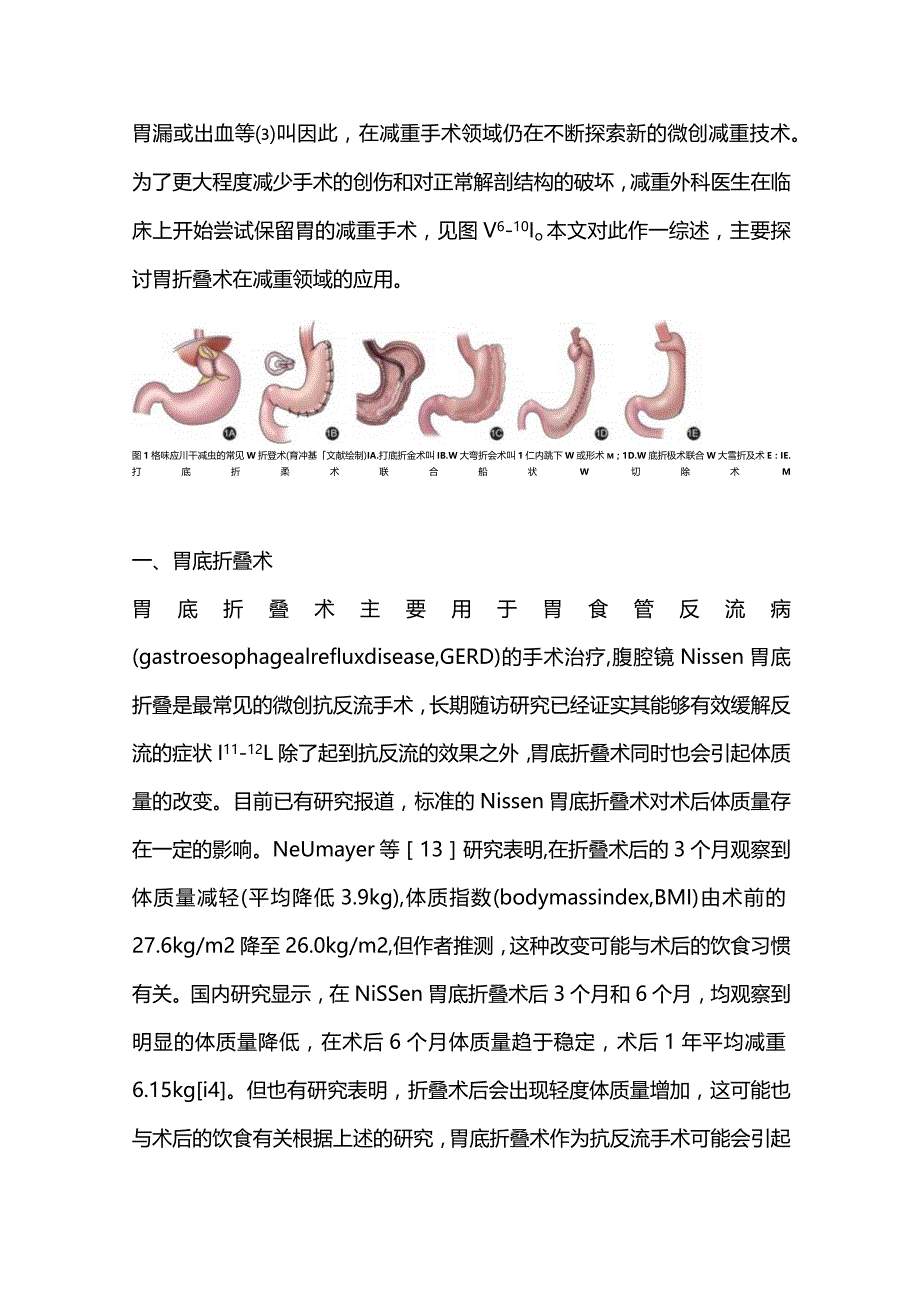 2023胃折叠术在肥胖治疗中的应用进展.docx_第2页