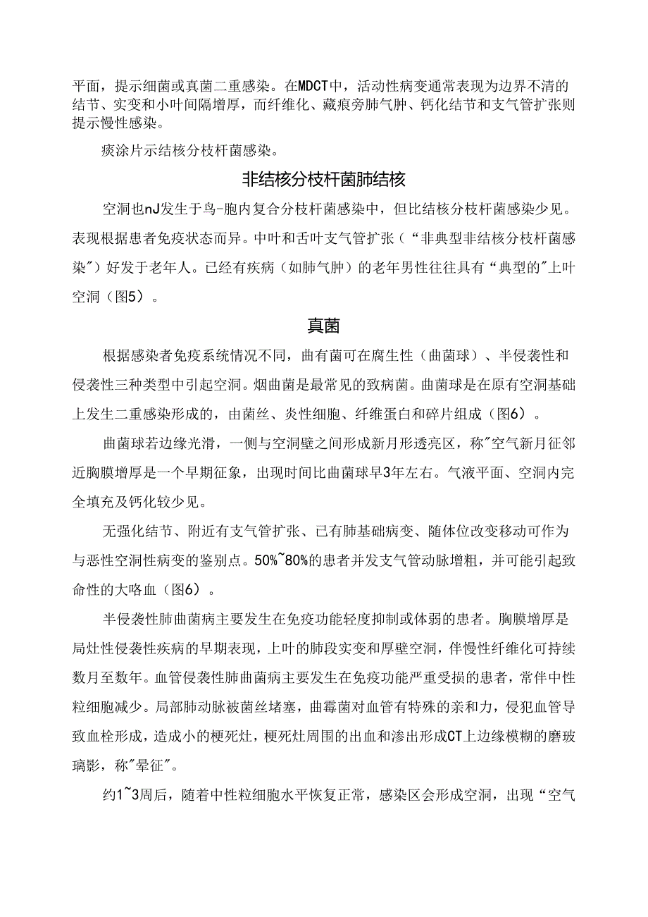 临床肿瘤、结核分枝杆菌肺结核、真菌、脓肿等肺出现空洞要点.docx_第2页