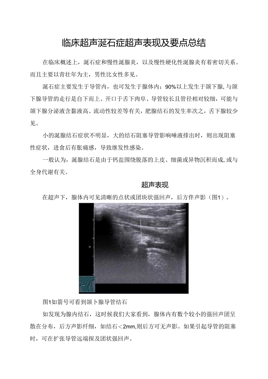 临床超声涎石症超声表现及要点总结.docx_第1页