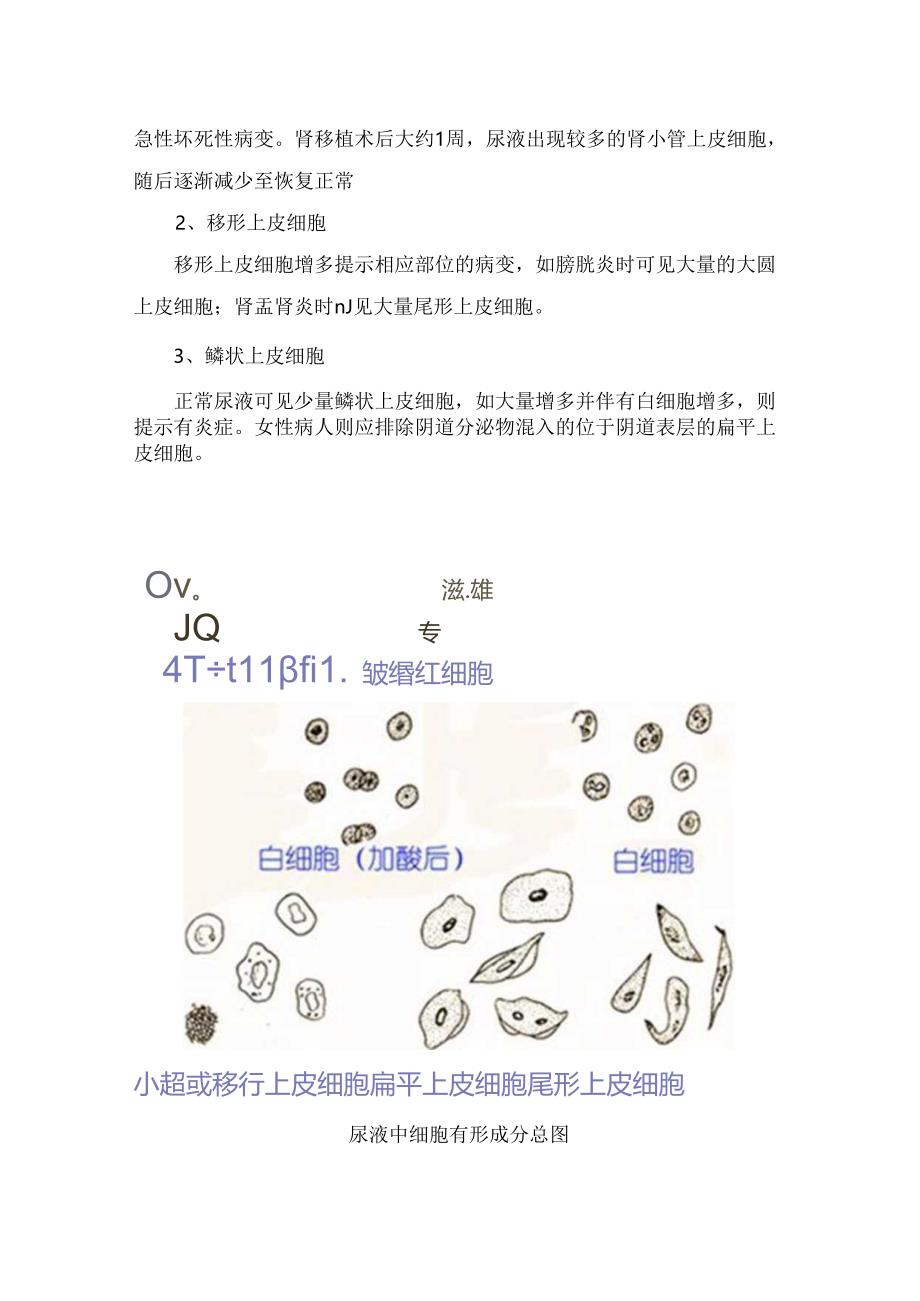 临床红细胞、白细胞、上皮细胞、结晶、其他成分等高清体液鉴别诊断.docx_第3页