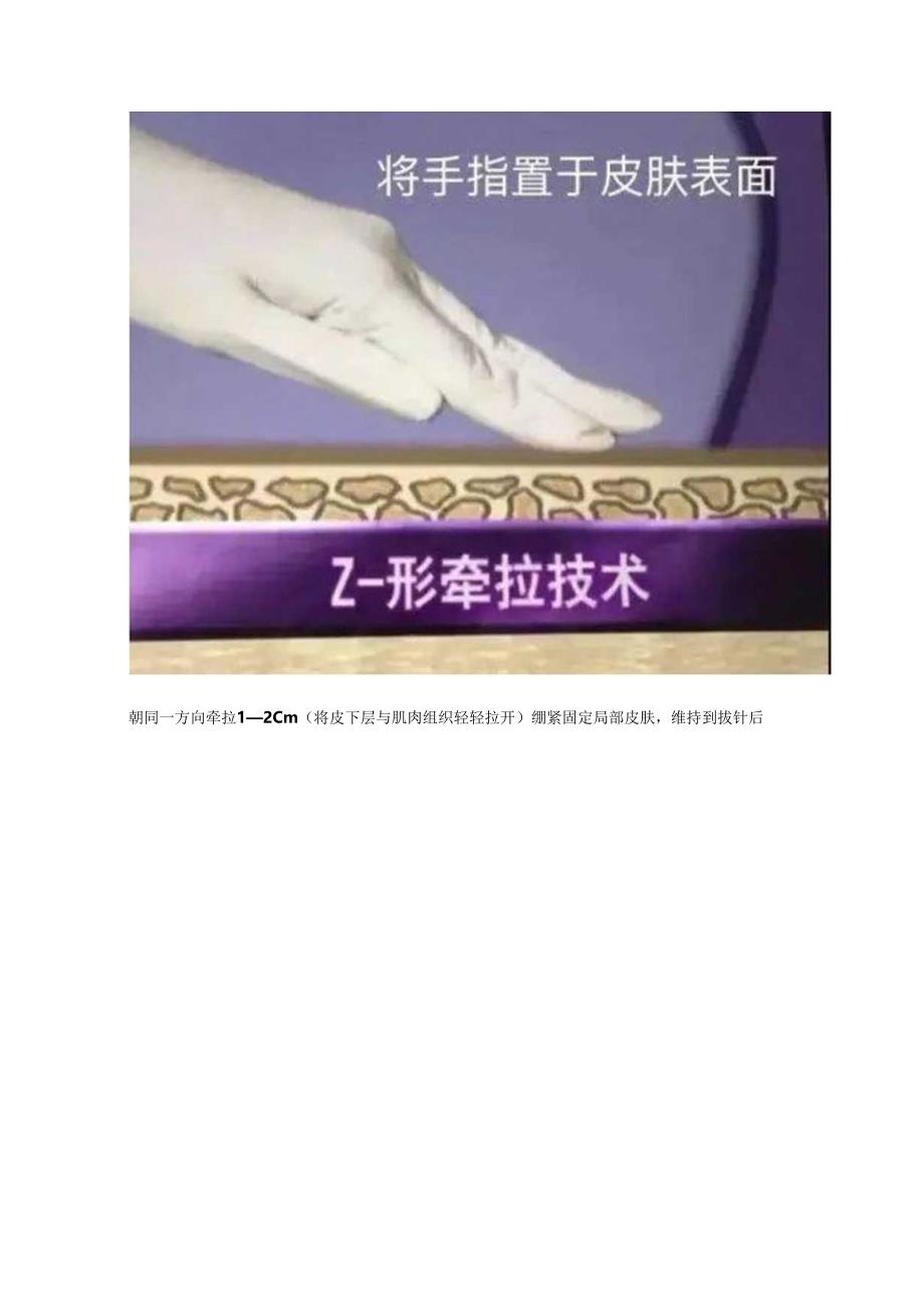 临床药物引起过敏反应发生主要因素、预防办法及操作方法.docx_第3页