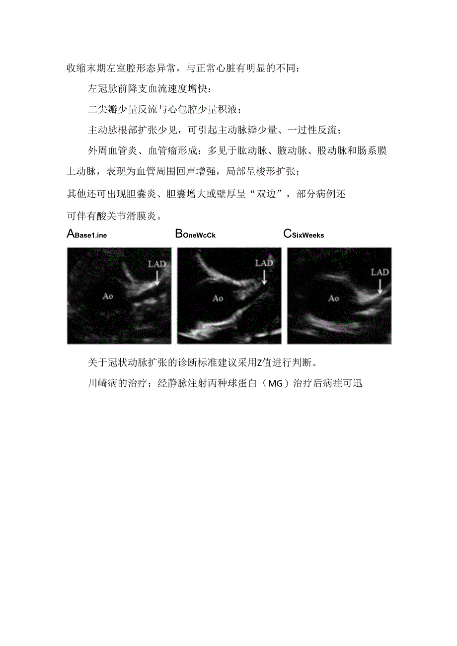 临床川崎病的超声心动图表现.docx_第3页