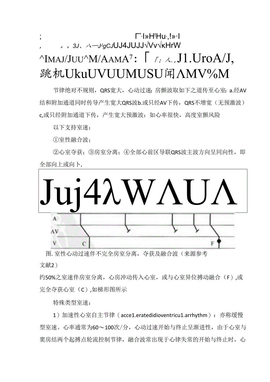 临床室性心动过速识别、治疗机急诊处置.docx_第2页