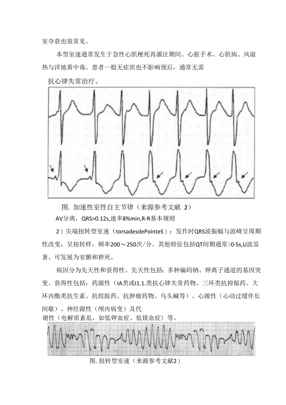 临床室性心动过速识别、治疗机急诊处置.docx_第3页