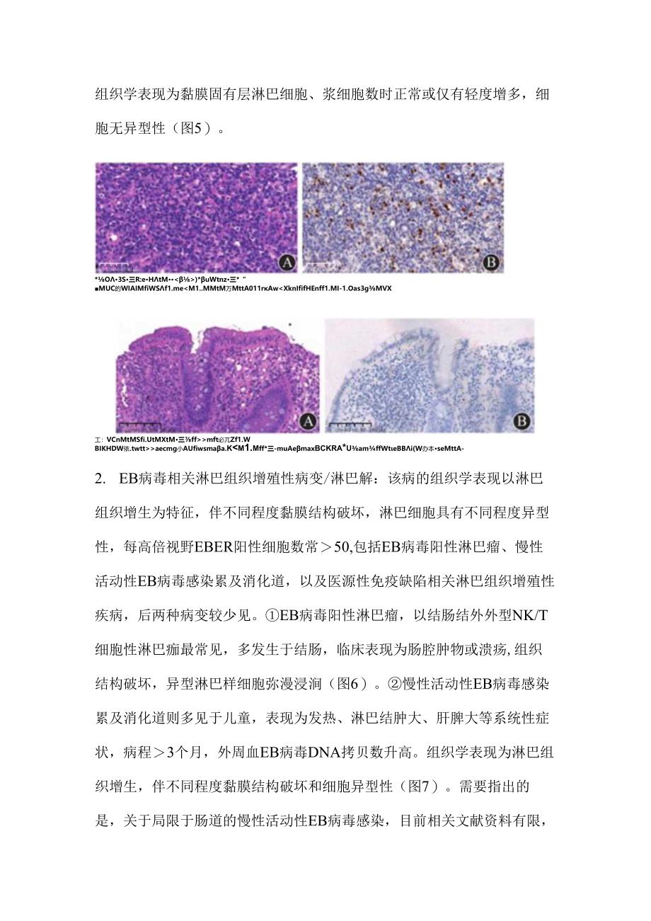 2024黏膜活检组织中EBER阳性的临床意义要点（附图表）.docx_第3页