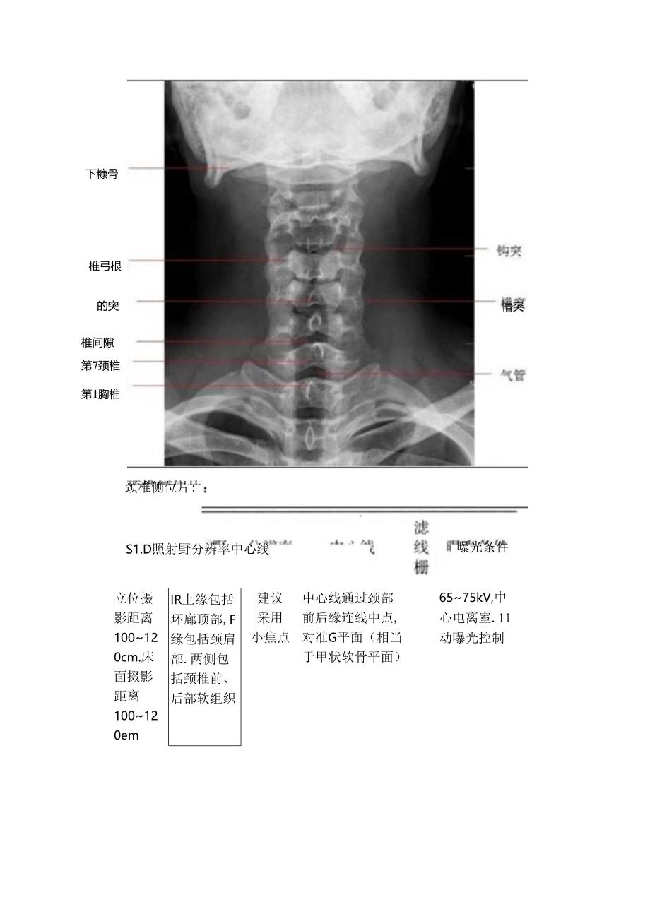 临床颈椎X线摄影距离摄影思考.docx_第2页