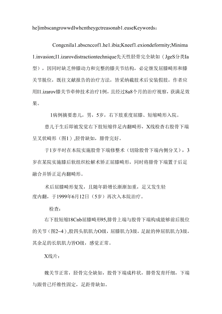 先天性胫骨缺如伴重度膝关节屈曲畸形的牵伸治疗1例.docx_第3页