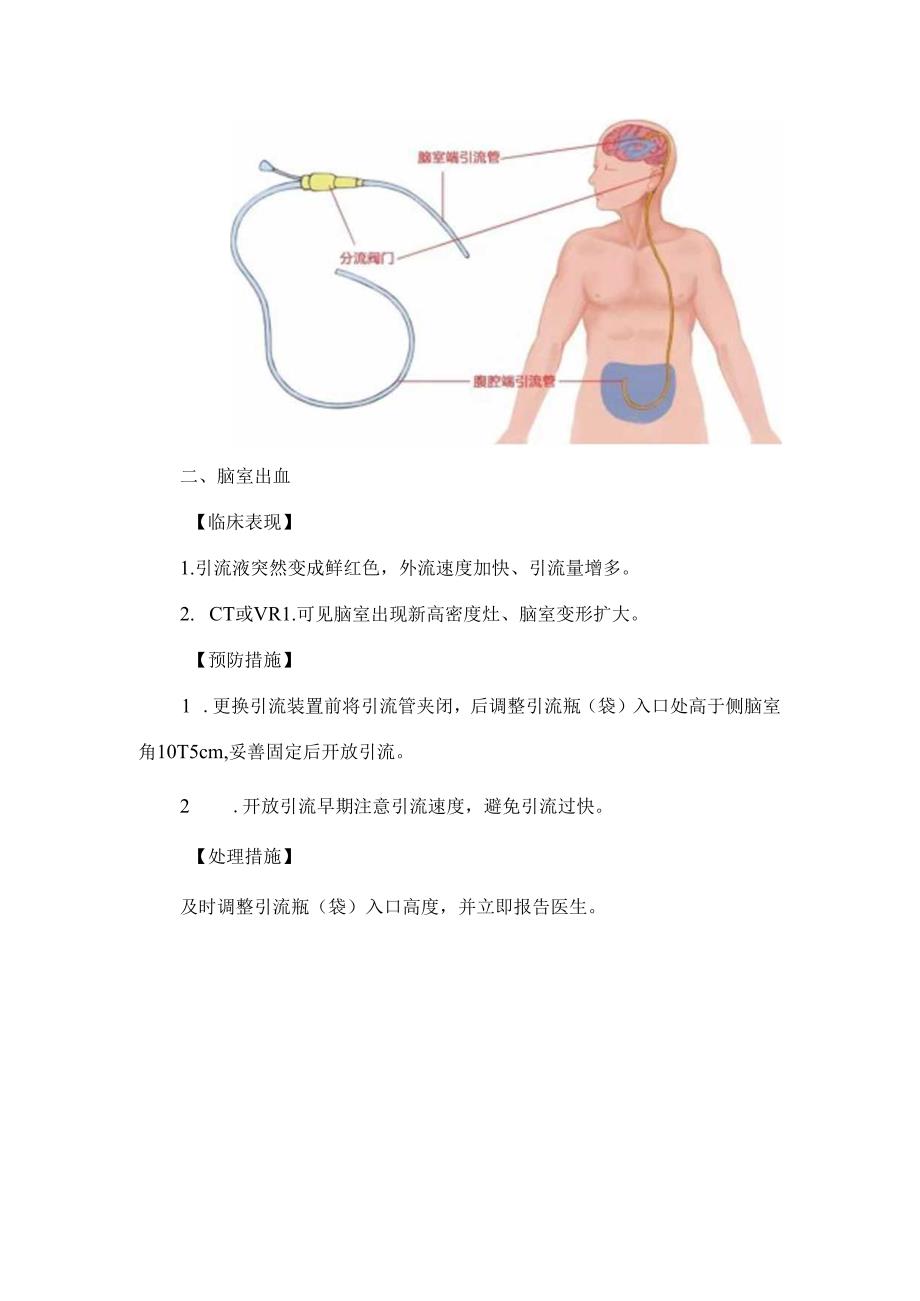 脑室引流管护理技术操作并发症的预防及处理.docx_第2页