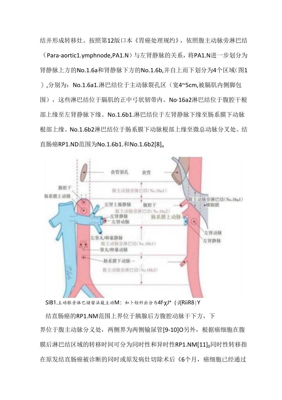 腹腔镜结直肠癌手术腹膜后淋巴结清扫关键技术.docx_第2页