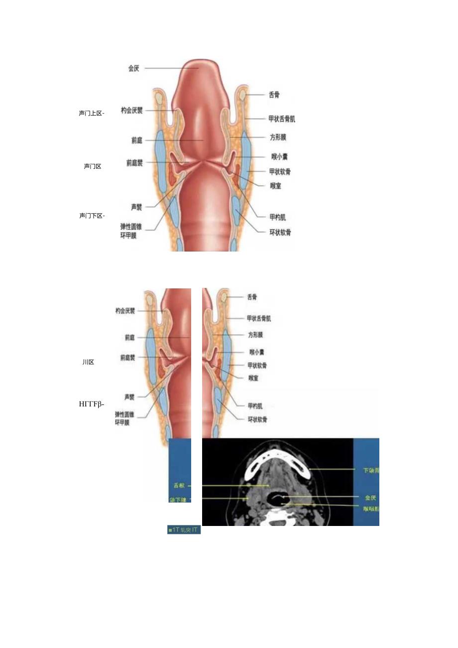 喉咽结构图解.docx_第2页