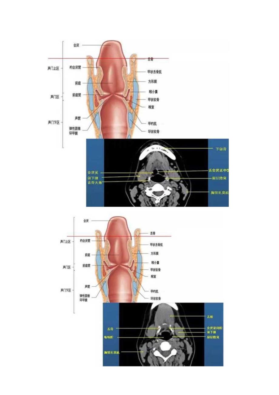 喉咽结构图解.docx_第3页