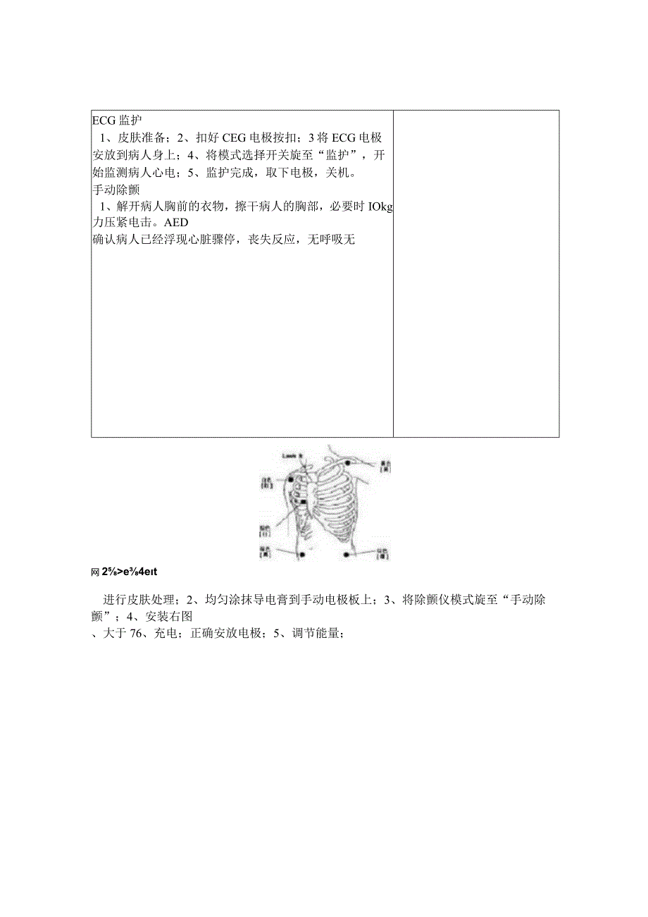 心电图的操作规程.docx_第2页