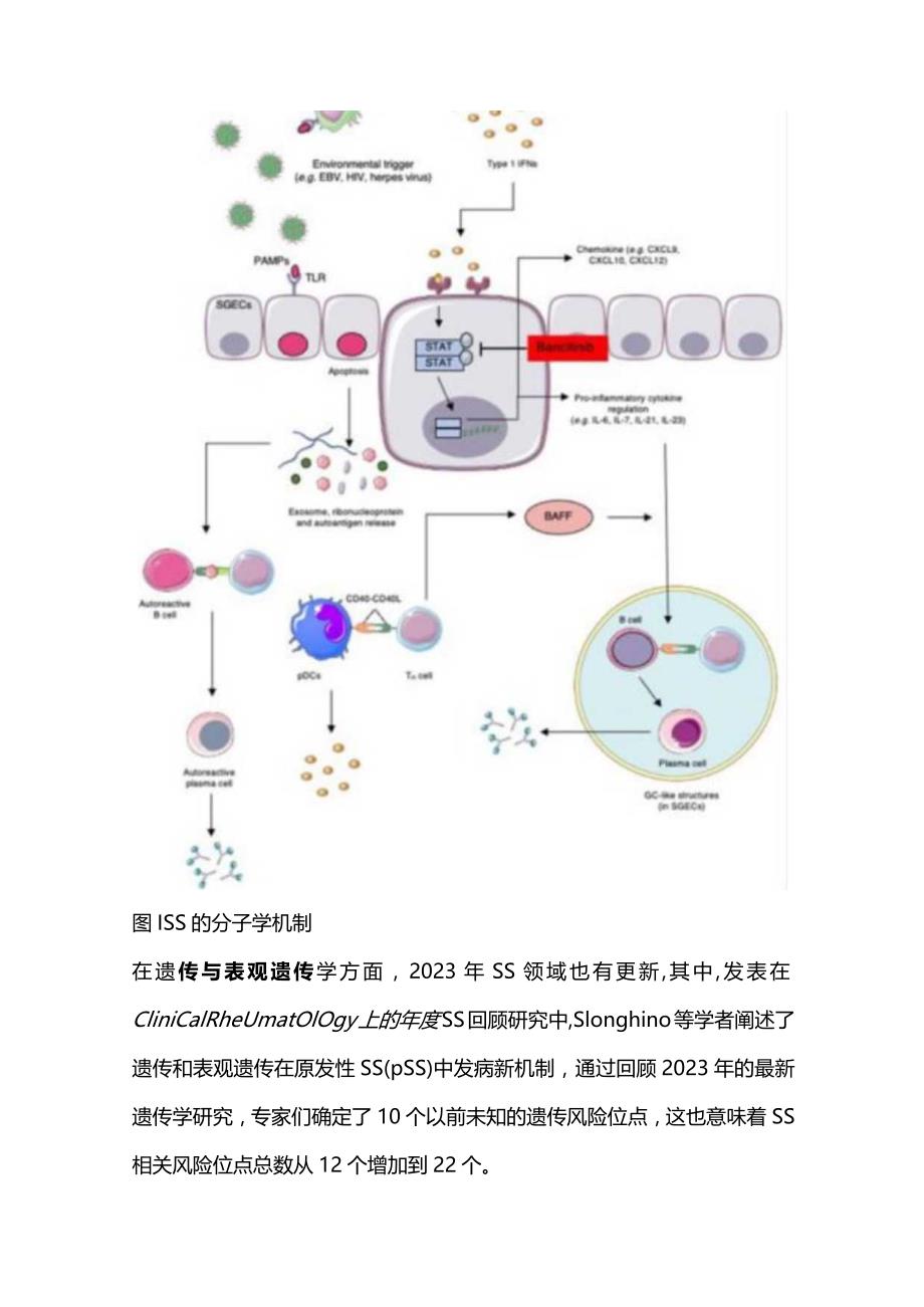 2024干燥综合征诊与治2023新进展.docx_第2页