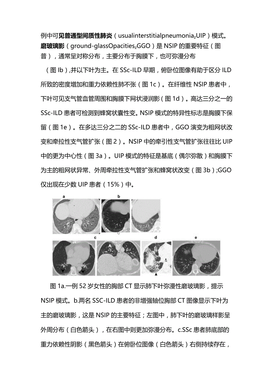 2024系统性硬化症相关间质性肺疾病的多学科评估.docx_第3页