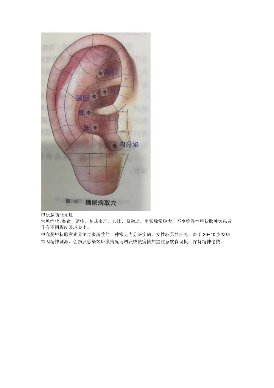 2.1耳穴调理糖尿病偏瘫甲亢.docx_第3页