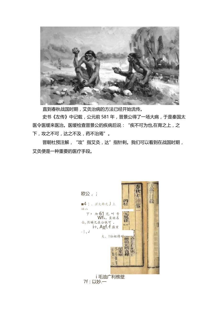 艾灸的发展史.docx_第2页