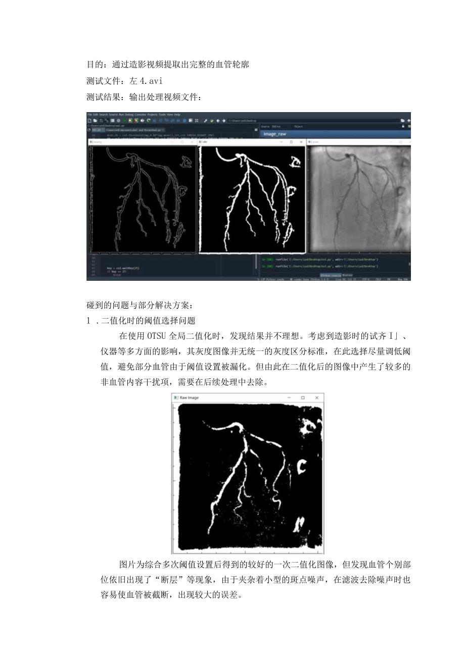 心脏造影血管提取.docx_第1页