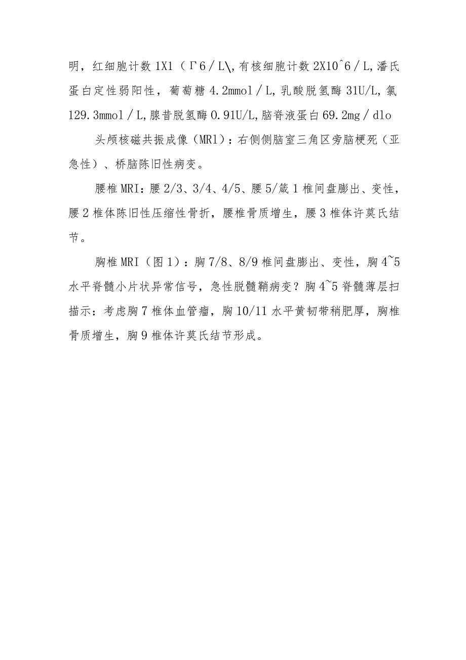 神经内科一例看似脑梗死的病例分析专题报告.docx_第3页