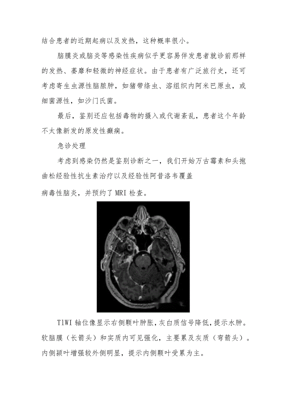 脑病科医师晋升副主任医师病例分析专题报告（单纯疱疹病毒脑炎）.docx_第3页