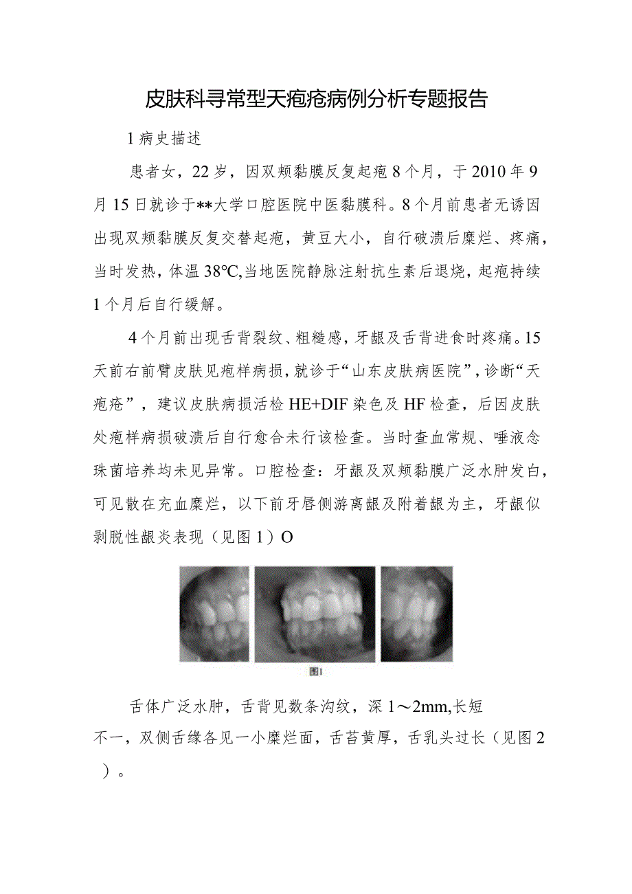 皮肤科寻常型天疱疮病例分析专题报告.docx_第1页