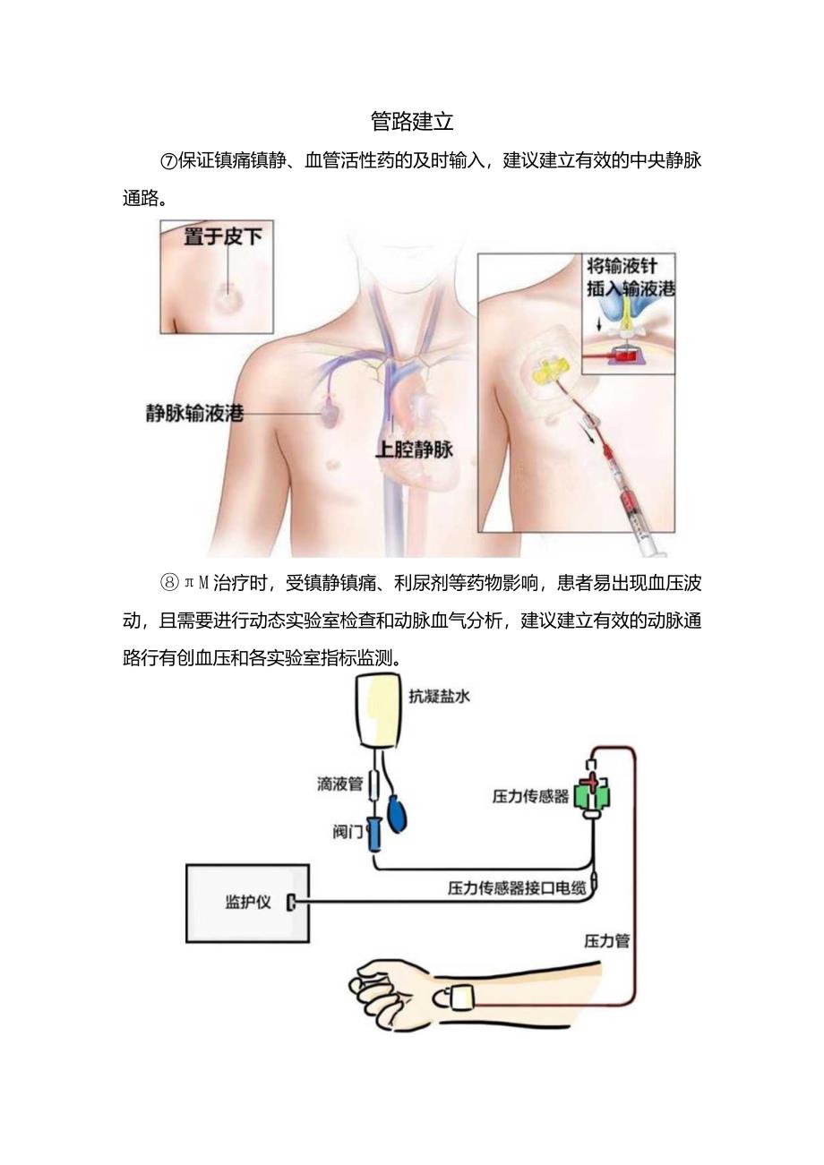 温度范围、启动时机、体温检测、镇痛镇静管理、营养支持、病情监测、神经功能预后评估等ICU脑损伤患者目标体温管理要点.docx_第2页