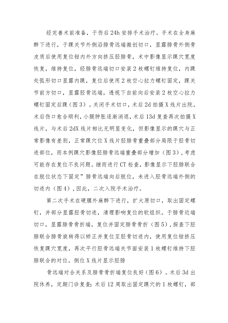 骨科手术治疗Maisonneuve骨折失误病例分析专题报告.docx_第2页