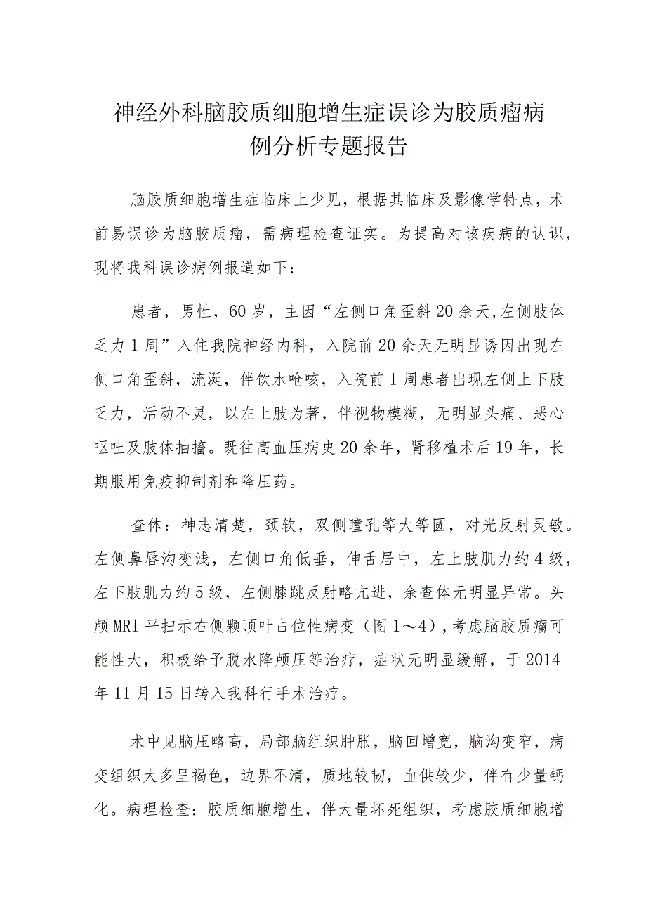 神经外科脑胶质细胞增生症误诊为胶质瘤病例分析专题报告.docx_第1页