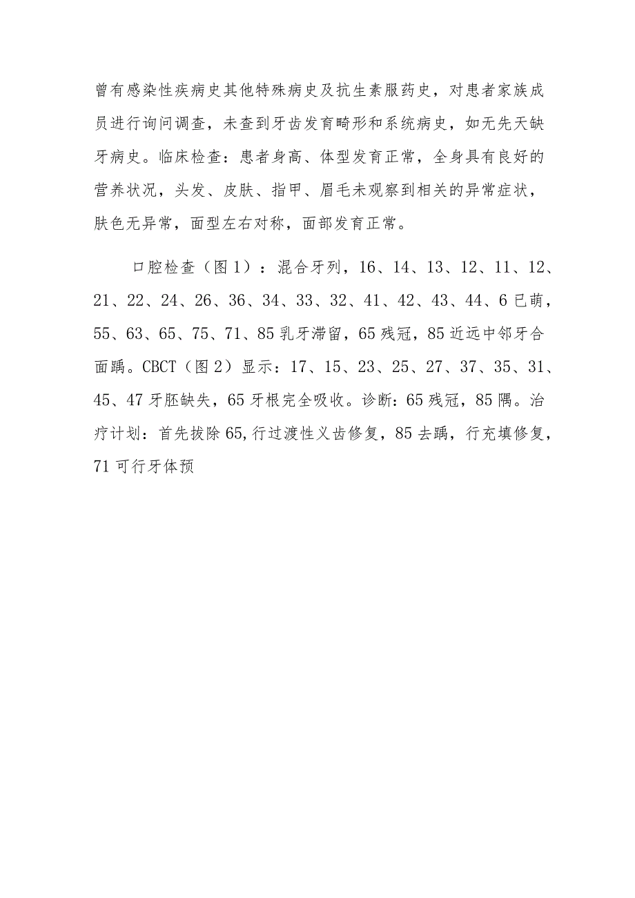 口腔科严重的少牙症病例分析专题报告.docx_第2页