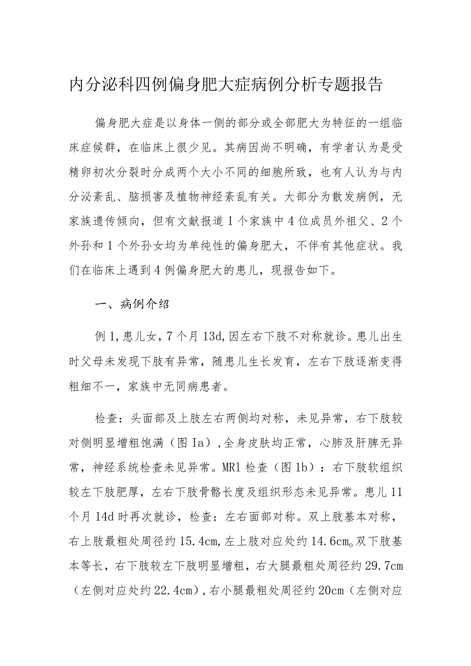 内分泌科四例偏身肥大症病例分析专题报告.docx_第1页