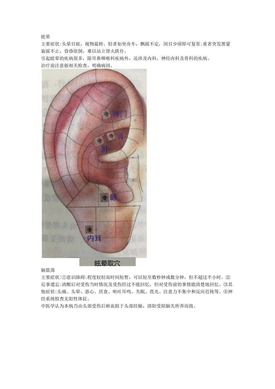 2.18耳穴 眩晕 神经衰弱.docx_第1页