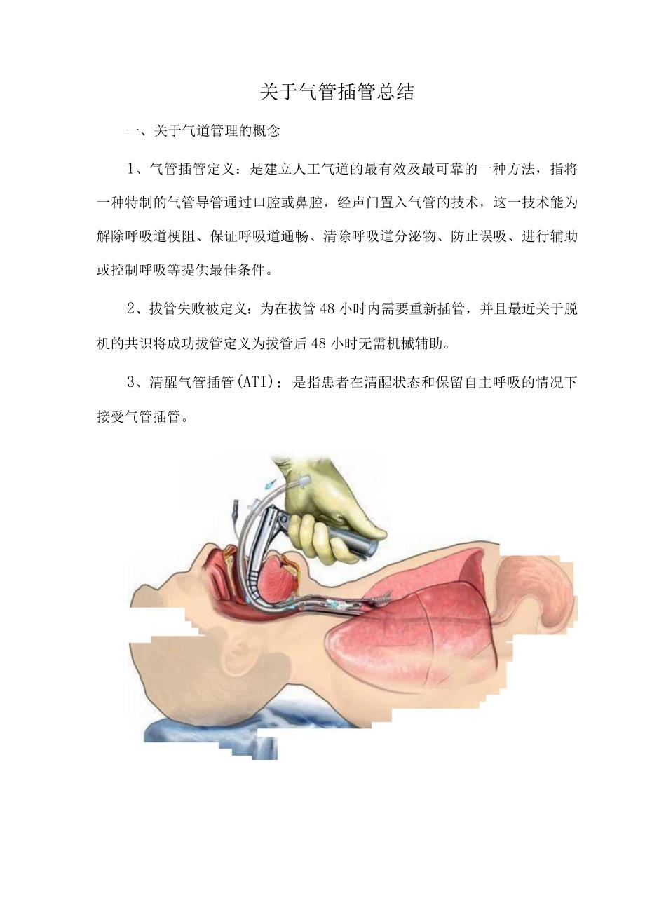 关于气管插管总结.docx_第1页