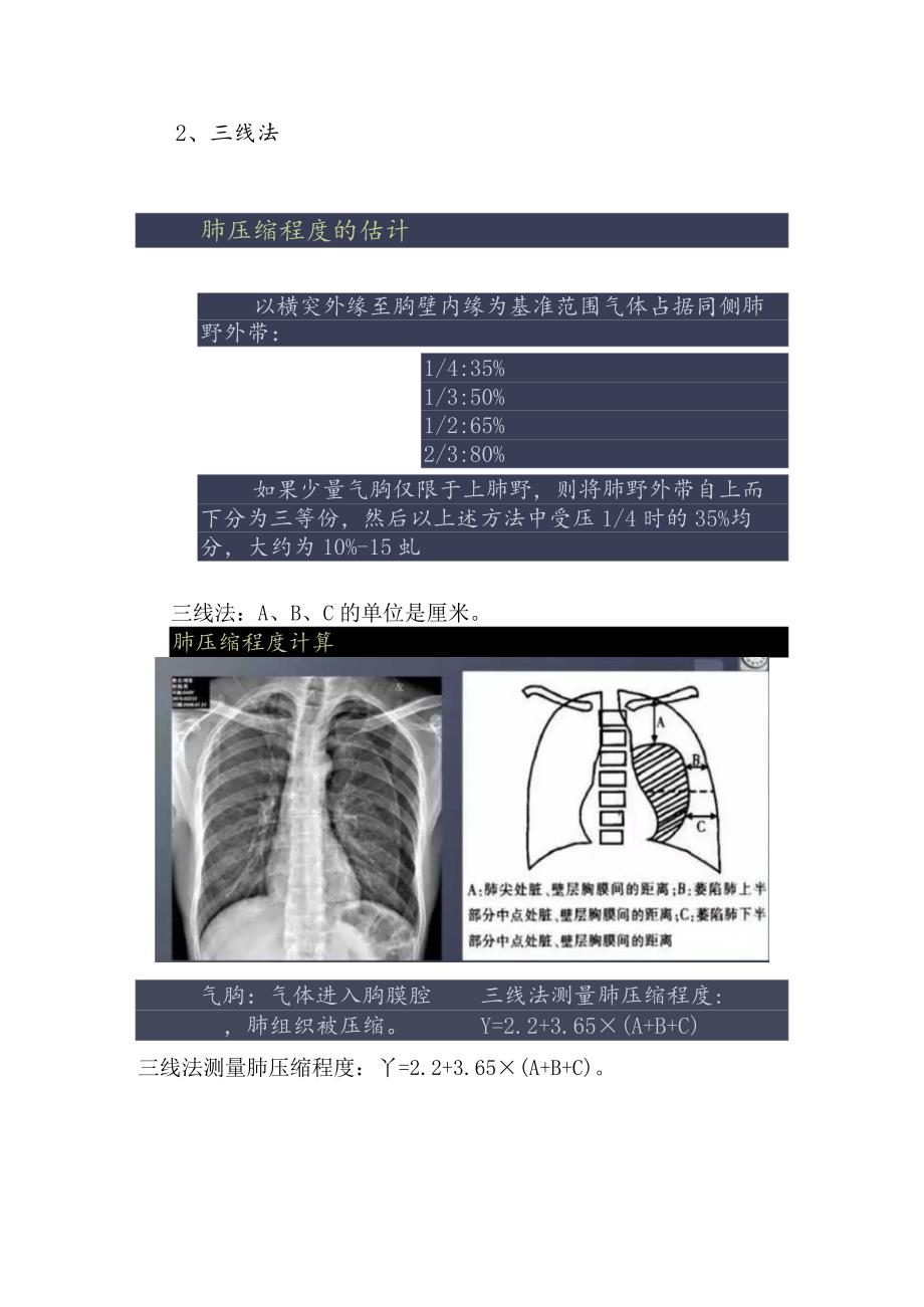 气胸肺压缩程度计算方法.docx_第3页