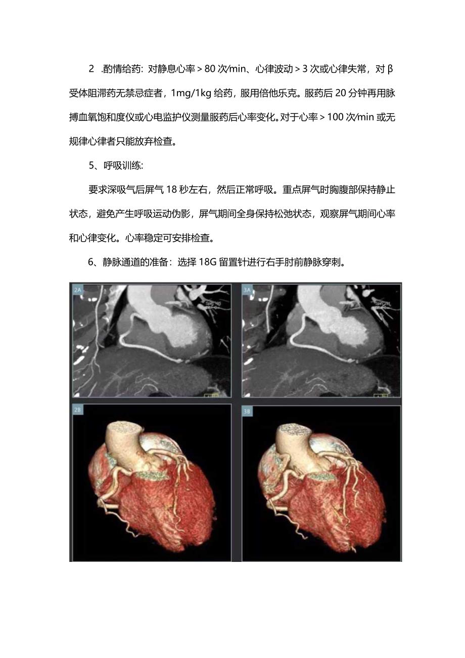 提高冠状动脉CTA检查成功率的护理要点.docx_第2页