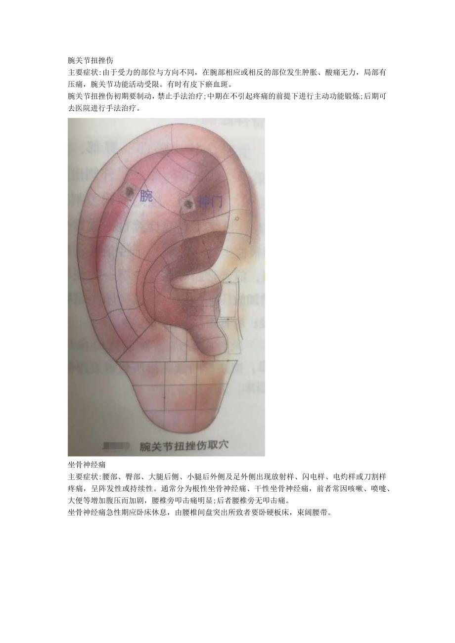 9.21耳穴 手腕扭伤 坐骨神经痛 膝关节炎.docx_第1页