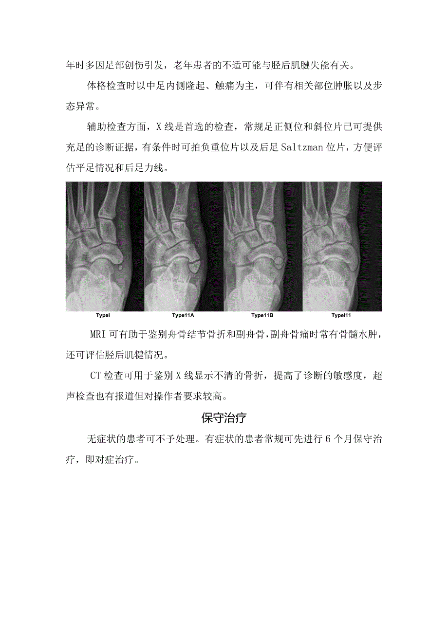 足副舟骨综合征病理、诊断、保守治疗及手术治疗.docx_第3页