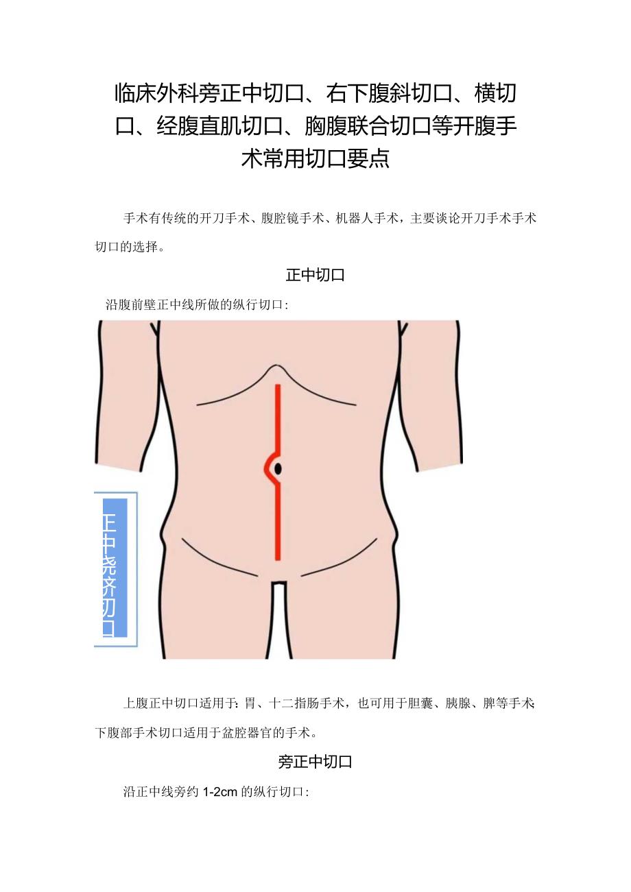 临床外科旁正中切口、右下腹斜切口、横切口、经腹直肌切口、胸腹联合切口等开腹手术常用切口要点.docx_第1页