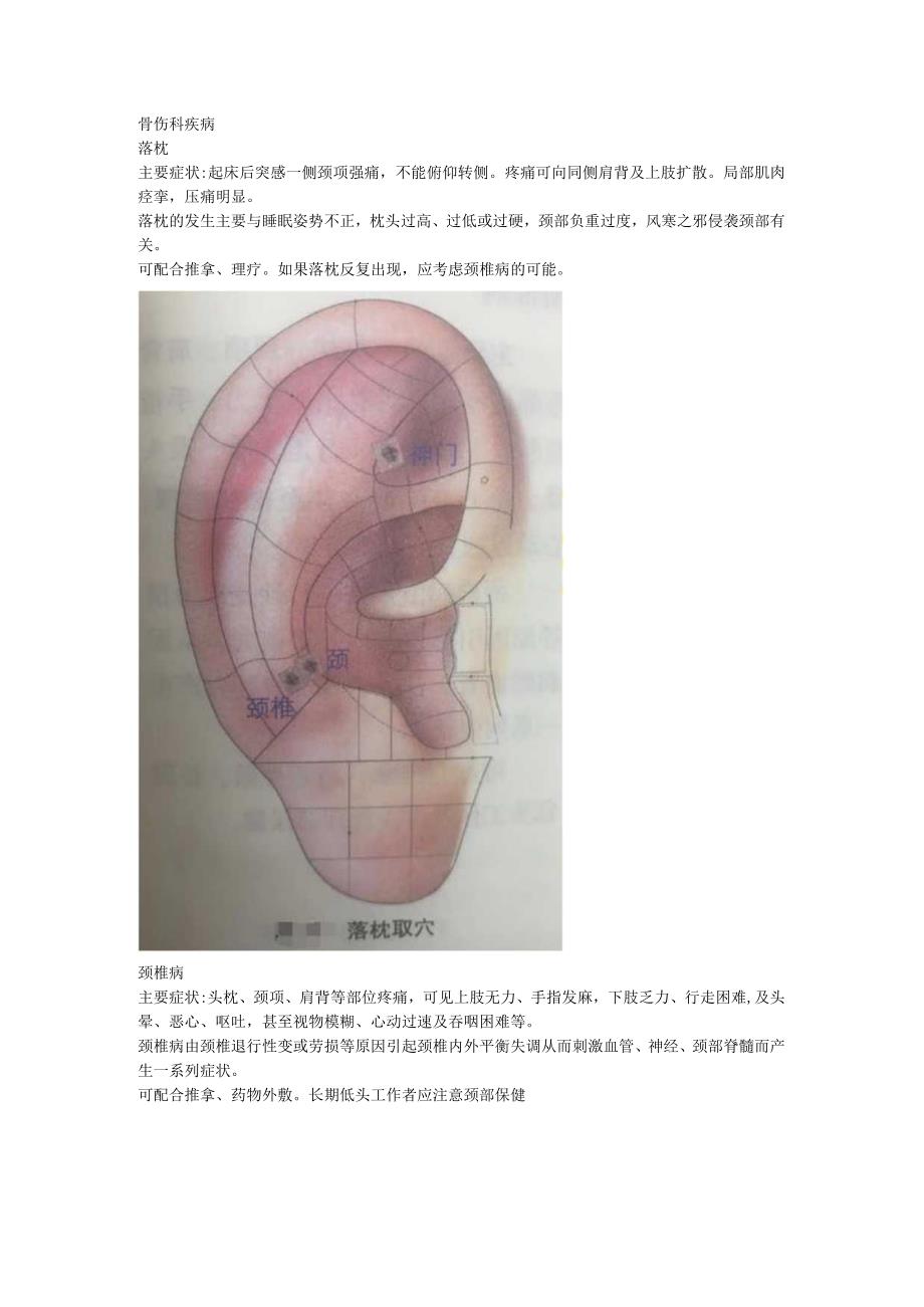 2.20耳穴 落枕 颈椎病 肩周炎 网球肘.docx_第1页