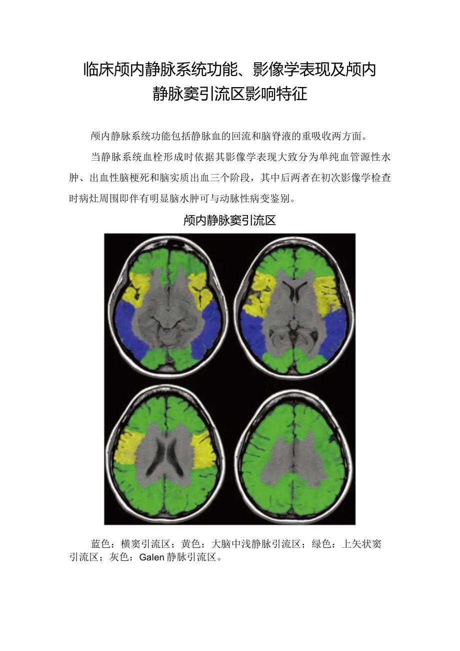 临床颅内静脉系统功能、影像学表现及颅内静脉窦引流区影响特征.docx_第1页