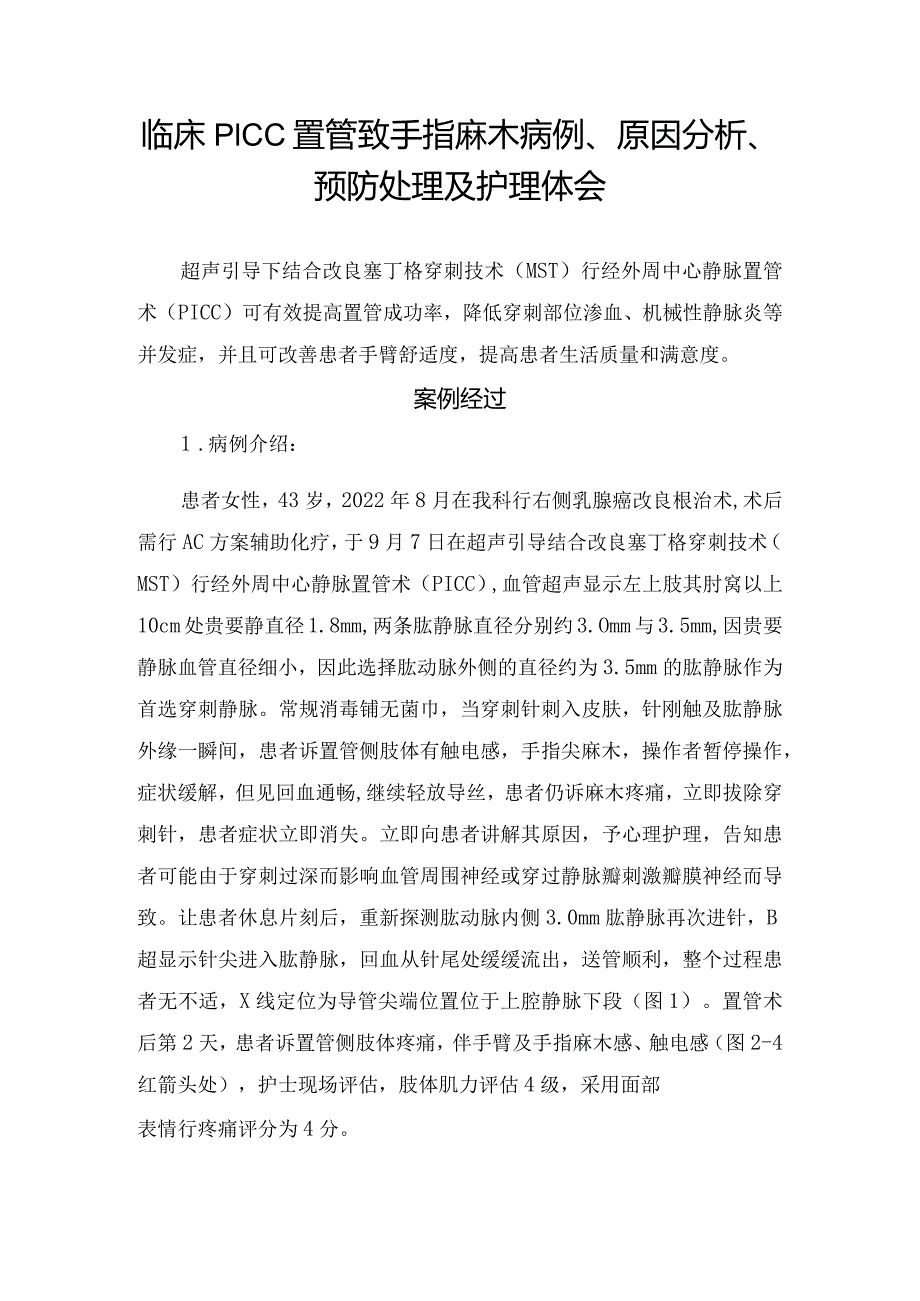 临床PICC置管致手指麻木病例、原因分析、预防处理及护理体会.docx_第1页