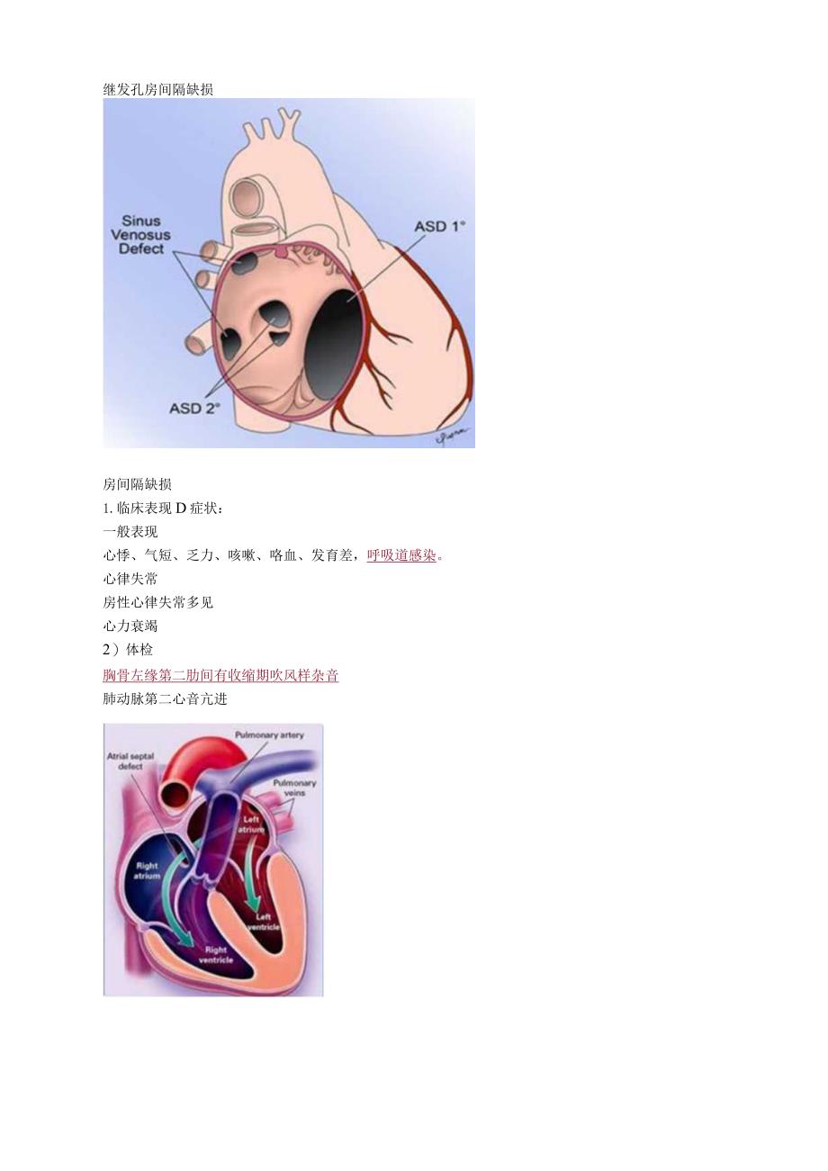 心血管内科主治医师资格笔试专业知识考点解析 (4)：先天性心血管病.docx_第2页