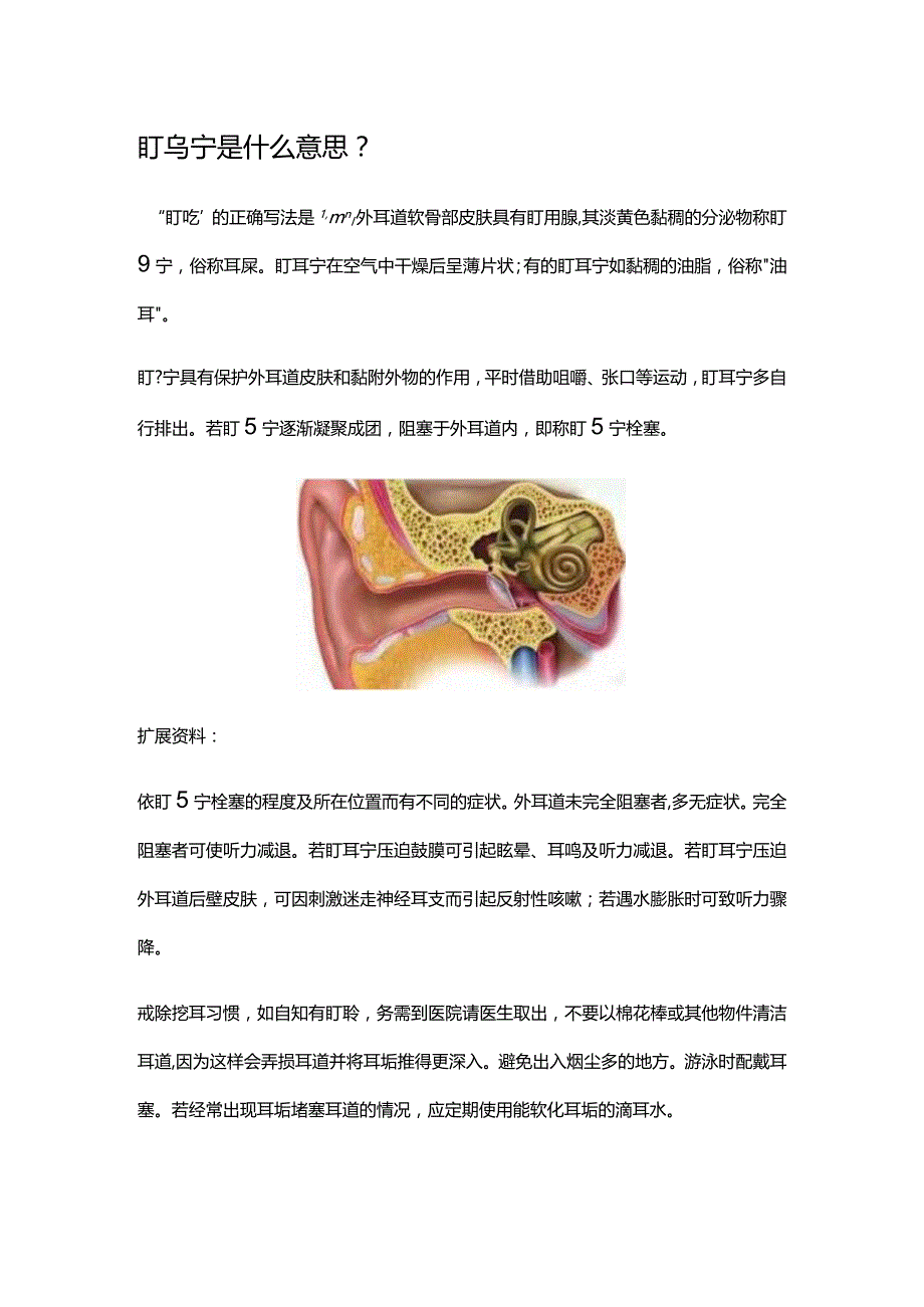 盯眝是什么意思.docx_第1页