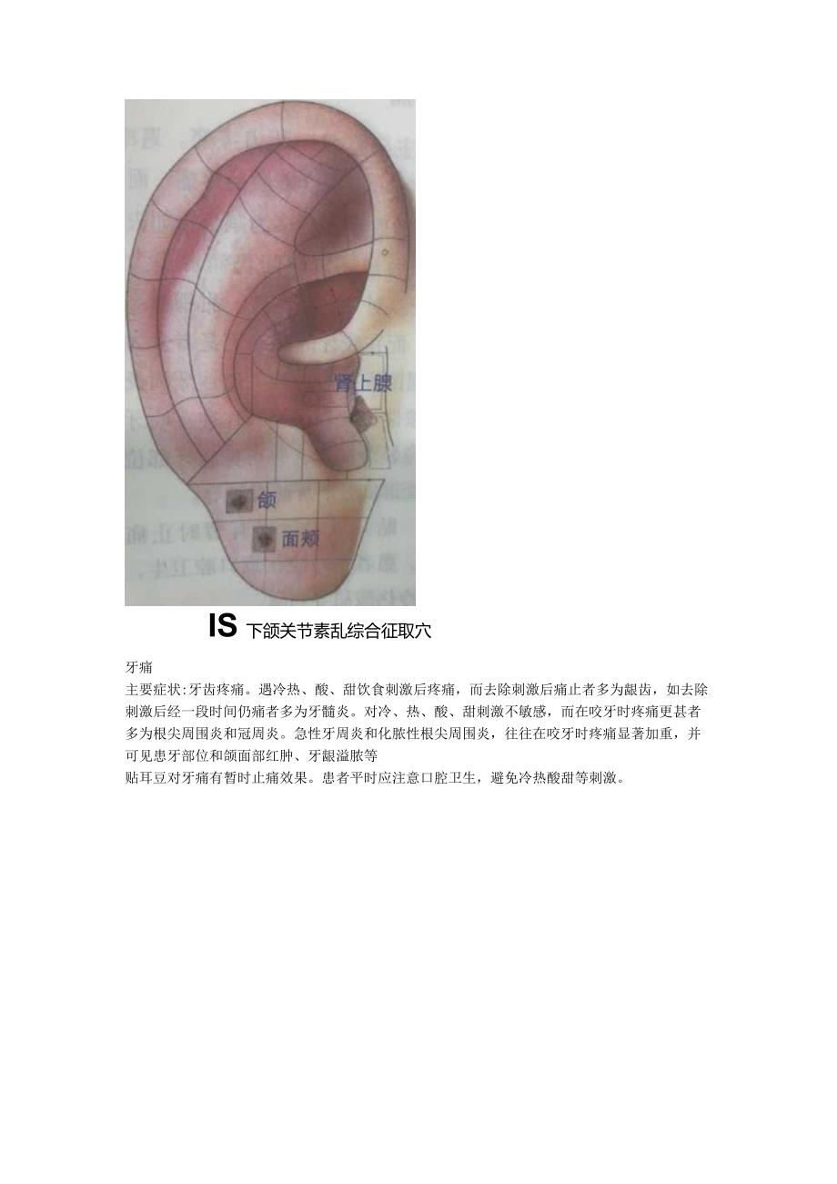 3.5耳穴牙疼扁桃体炎肥胖.docx_第2页