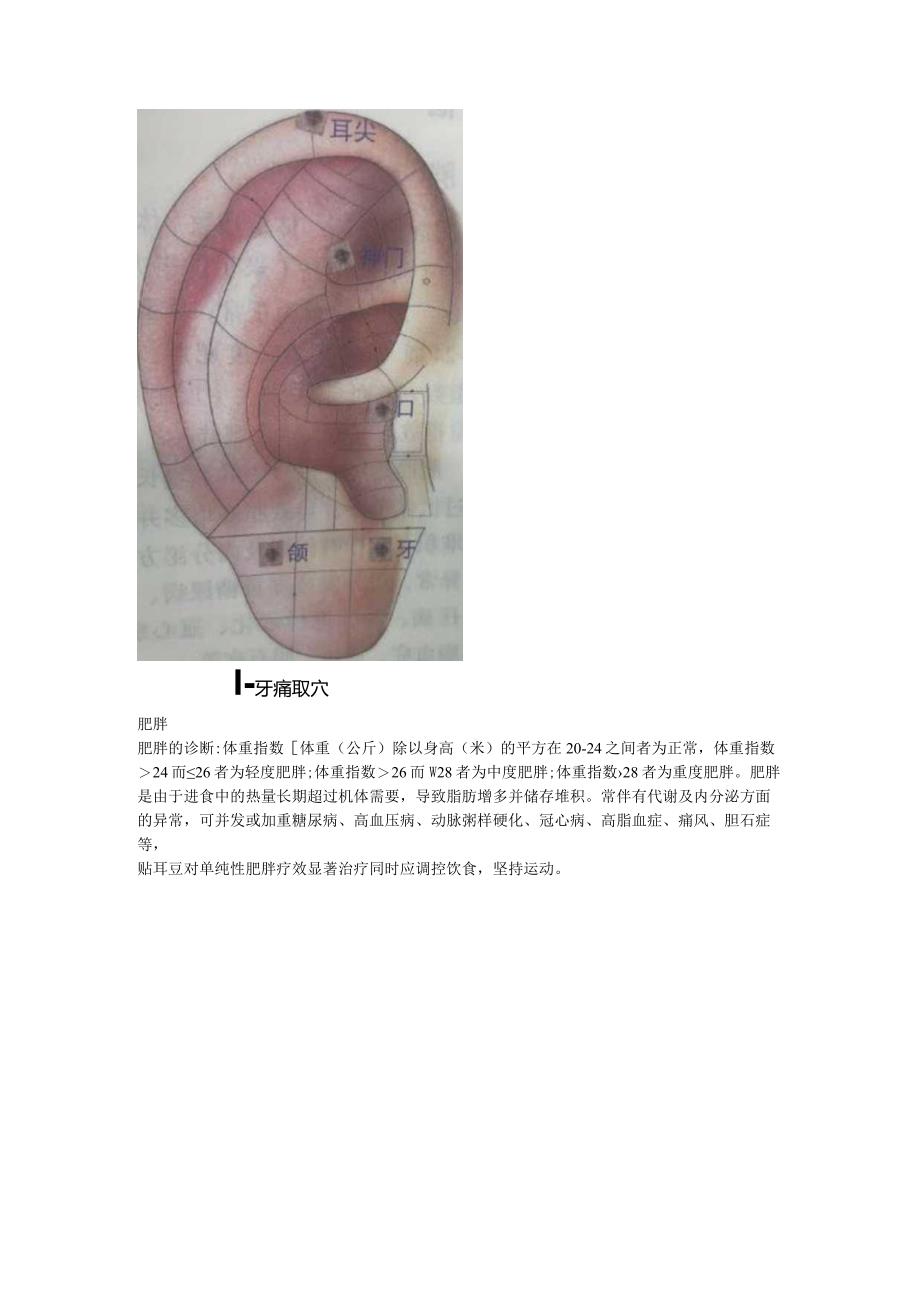 3.5耳穴牙疼扁桃体炎肥胖.docx_第3页