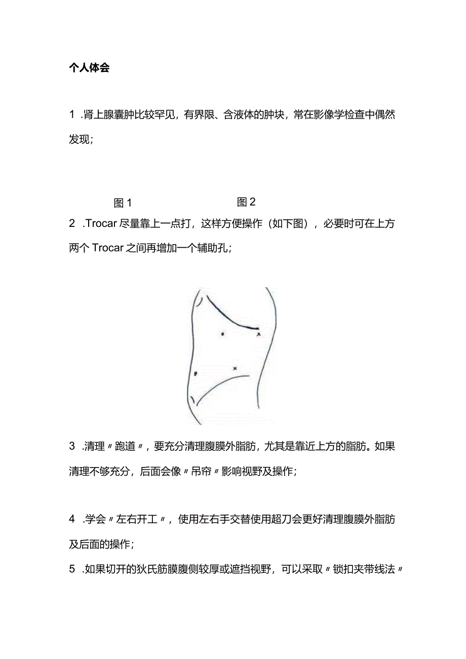 2024腹腔镜下右肾上腺肿瘤切除术.docx_第2页